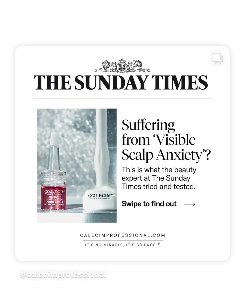 The Sunday Times — Visible Scalp Anxiety