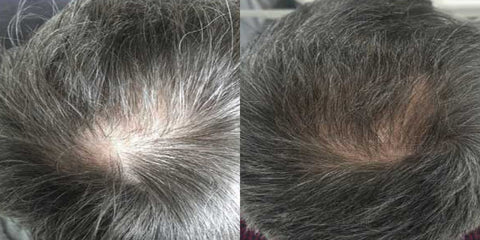 Calecim Before & After with Kelly Morrell