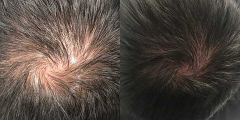 Calecim Before & After 2